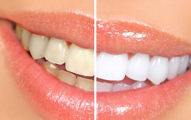 Before & After Treatment